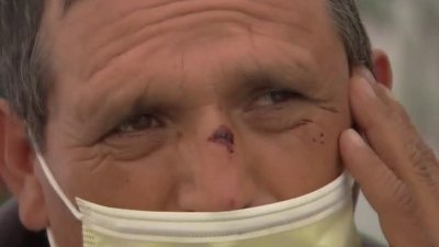 Captado en cámara: Elotero hispano narra violento robo a pleno día