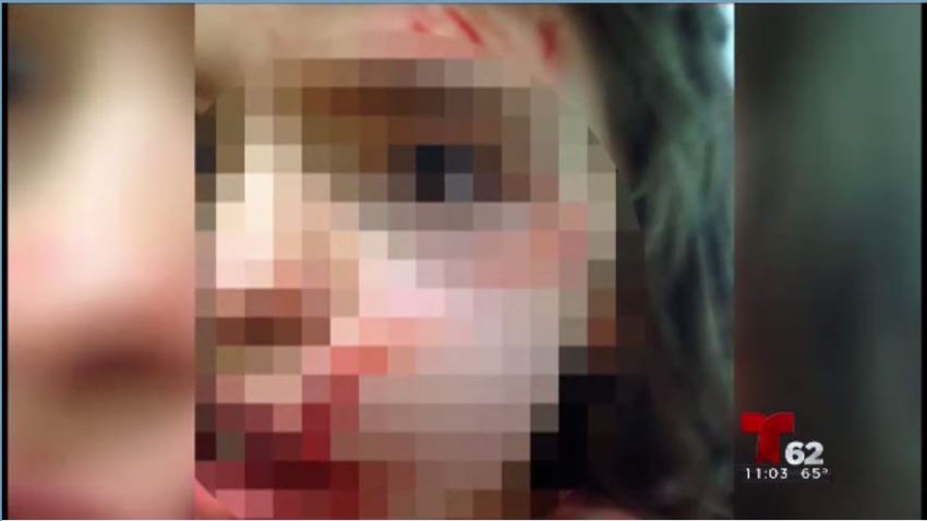 nina discapacitada 8 oct1
