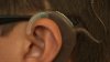 FDA da pasos para que aparatos para ayuda auditiva se compren sin receta médica
