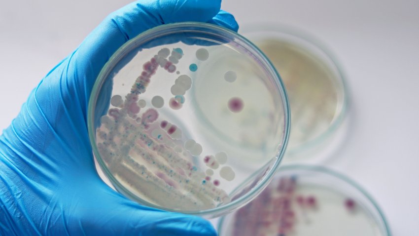 Researcher is holding Petri dish of Vibrio vulnificus in CHROMagar and TCBS, an estuarine bacterium which occurs in in filter-feeding molluscan shellfish, such as oysters., ingestion of the bacterium.