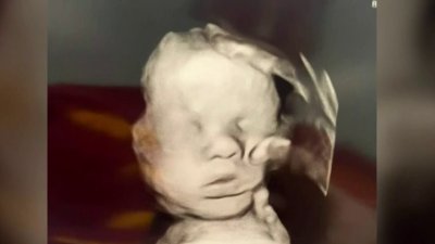 Madre afirma ver “la mano de Dios” en ultrasonido de su bebé